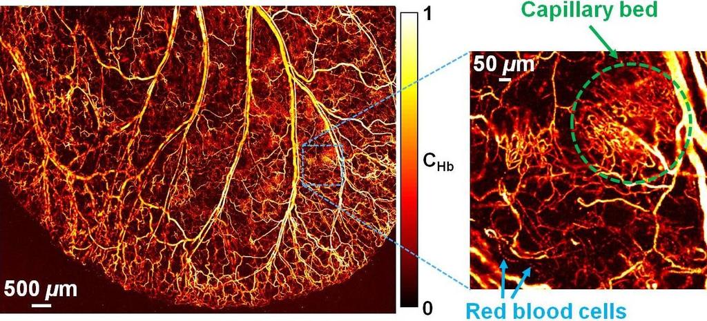 In vivo photoacoustic microscopy Anatomy Label-free photoacoustic microscopy images the concentration of hemoglobin and reveals the vascular anatomy down to