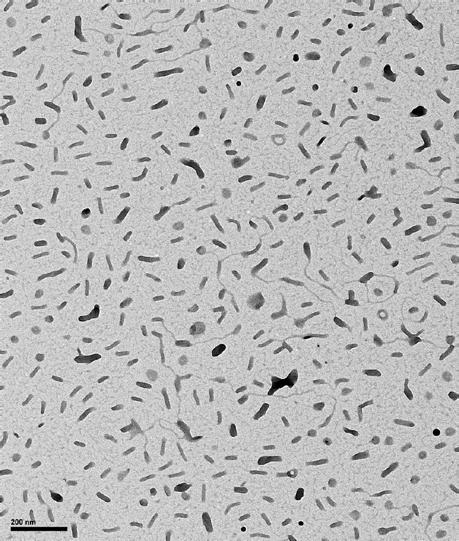 transfection following SC injection of DNPs in NZW rabbits Rods