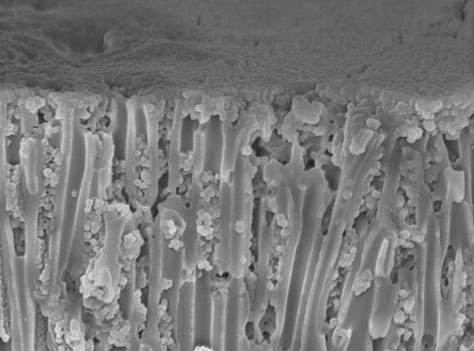 Functionalization Improved sedimentation technique 1 µm 1 µm 200 nm