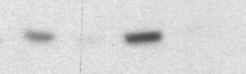 SB203580 (2 µm) : - + - + pt180/y182-p38 p38
