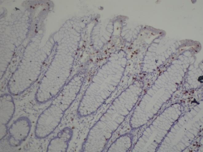 Fig.1: Optimum staining of colonic mucosal T-cells
