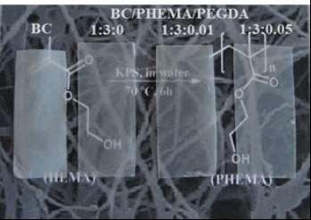Composites by in situ polymerization