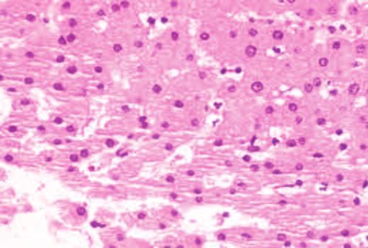 Histologic Preparations: Common Problems and Their Solutions Figure 1.10. A liver biopsy showing the effects of over-dehydration.