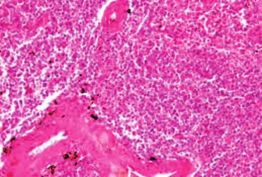 Histologic Preparations: Common Problems and Their Solutions Figure 1.16. A section of spleen containing marked formalin pigment. This section is also not well fixed or well stained. Figure 1.18.
