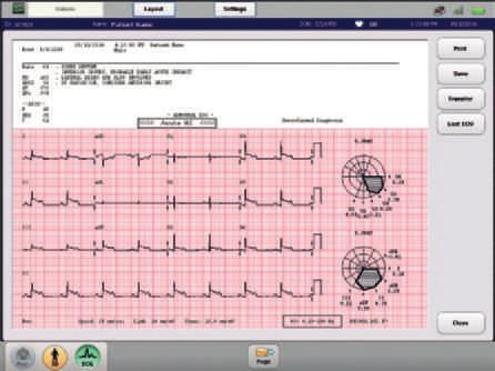 reading and diagnosis through all PageWriter products and the IntelliSpace ECG management system.