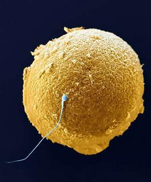 Zygote = a a sperm (or pollen) cell that forms from with an egg.
