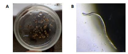 Collection of Meloidogyne spp., A. Egg masses, B.