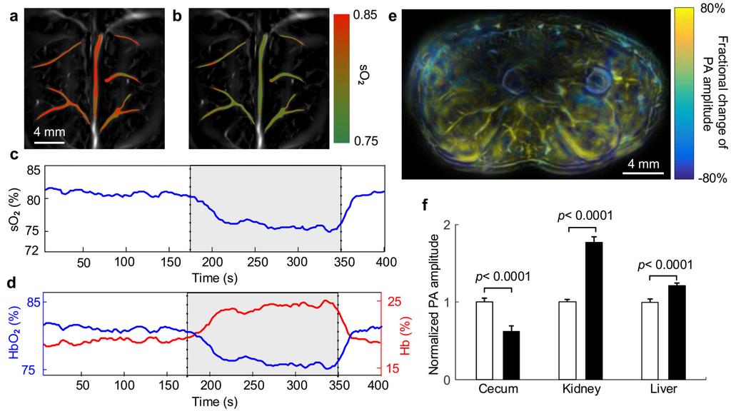 Li et al. Page 23 Figure 4. SIP-PACT of mouse whole-body oxygenation dynamics. so 2 mapping of mouse cortical vasculatures during (a) hyperoxia and (b) hypoxia.
