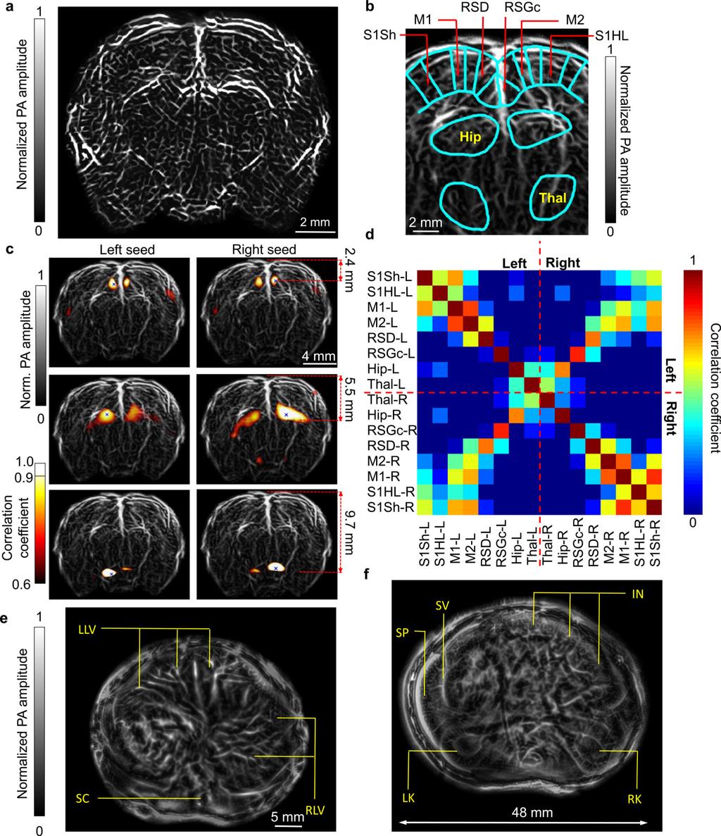 Li et al. Page 25 Figure 6. Deep imaging of rat whole brain functions and whole-body anatomy. (a) Rat whole brain vasculature in the coronal plane.
