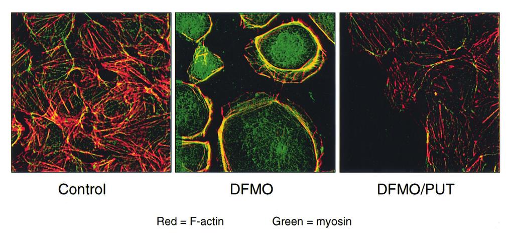 FIGURE 3. Immunocytochemical localization of F-actin (red) and nonmuscle myosin II (green) (yellow represents the combination of the two) in IEC-6 cells.