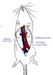 irreversible dilatation of a vessel which can lead to its rupture; Abdominal aortic aneurysm Aim & Strategy of the Project Aim: Implantation of the developed decellularised rat abdominal aortas in