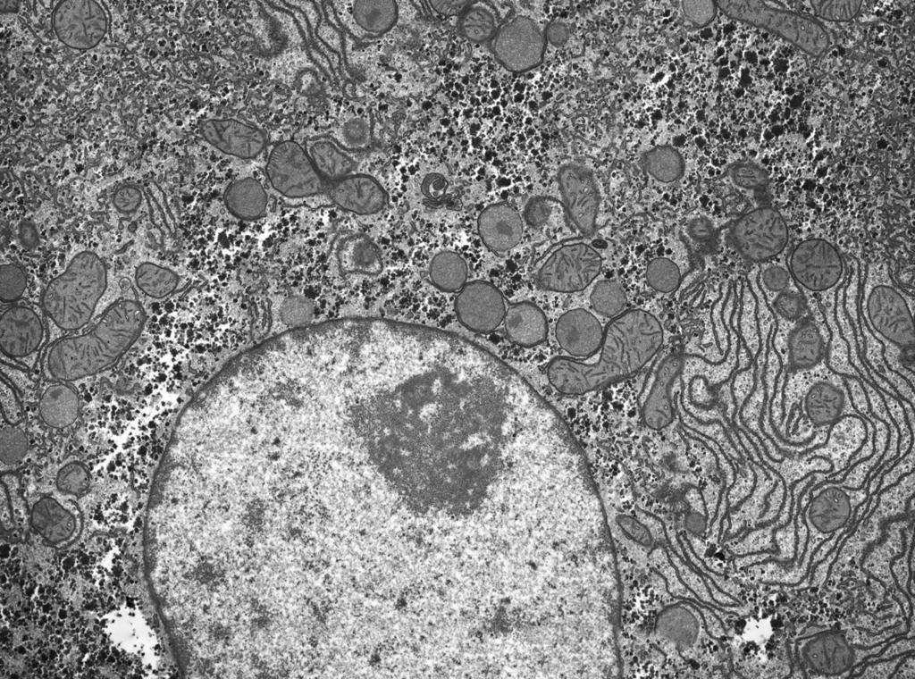 (b) Fig. 1.1 is a photomicrograph of a liver cell.