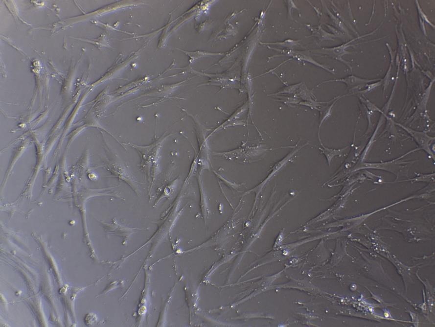 89 10µm Figure 4.45 Optical image (brightfield) of IMR-90 on culture plate after 24 hours seeding, initial seeding density: 20,000 cells / well.