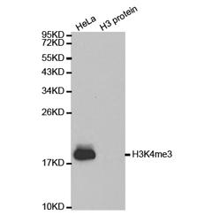 Immunohistochemistry of paraffin-embedded human rectal cancer tissue using H3K4me3