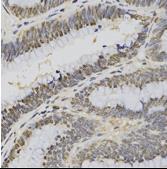 analysis extracts of 293 cell line, using H3K4me3 Polyclonal Antibody and rabbit IgG.