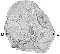 Q7. A) The cheek cell in Figure 2 is magnified 250 times. The width of the cell is shown by the line D to E. Figure 2 Calculate the width of the cheek cell in micrometres (µm).
