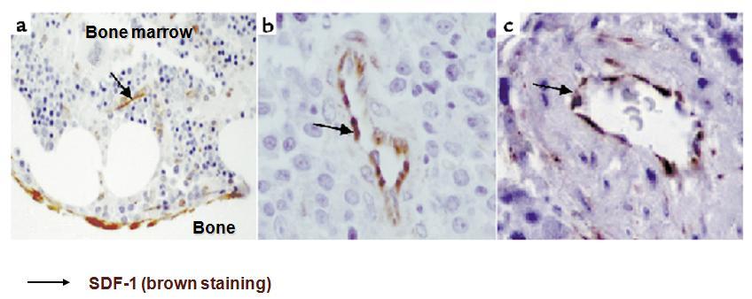 The chemokine SDF-1 (CXCL12), is expressed by CXCR4+ endosteal human bone lining osteoblasts (a) and by endothelial and reticular cells (b,c).