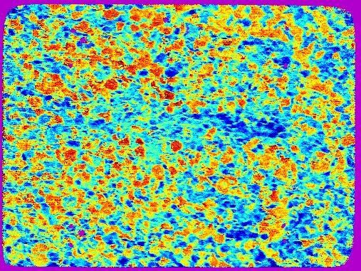 Grain clusters in titanium alloy 76x57mm velocity map of titanium alloy Colours represent SAW phase velocity in horizontal direction Dark blue region