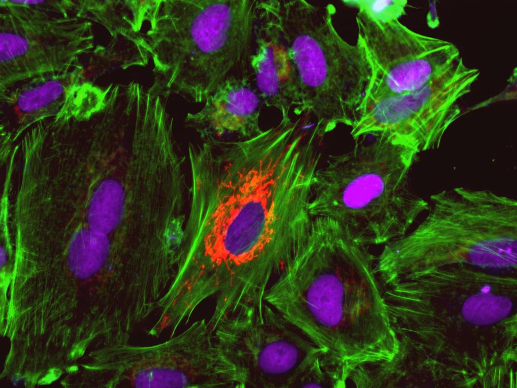 Figure 4. HeLa cells were transduced with CellLight Mitochondria-RFP, BacMam 2.0 and treated with DNase to induce TUNEL positive DNA strand breaks.