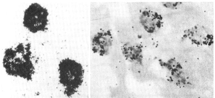 102 Tiwari and Lakhotia Figure 1. [ 3 H] Thymidine labelled autoradiograms of follicle cells of D.