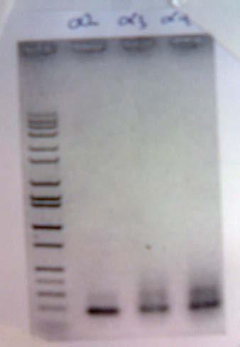 MW α2 α3 α4 200bp 100bp 186 bp PCR products of Clostridium septicum α toxin fragments 2, 3, and 4.