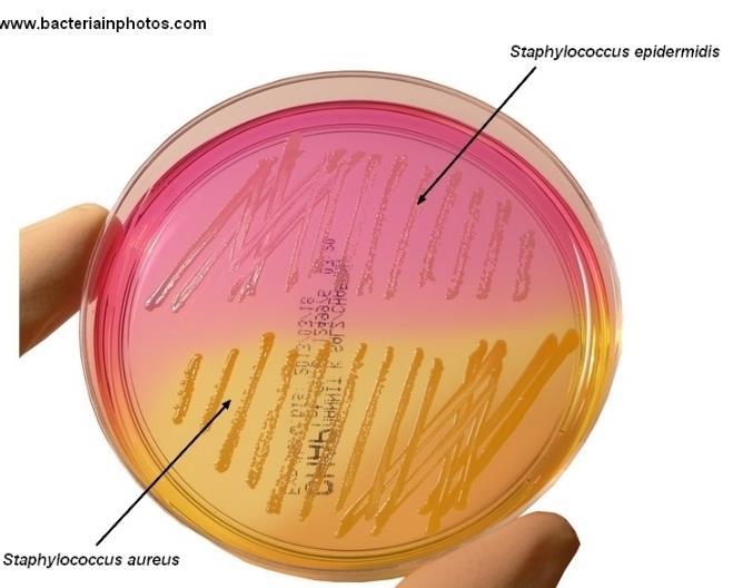 The yellow disc in the image to the right was infused with antibiotic. E. ph 3.