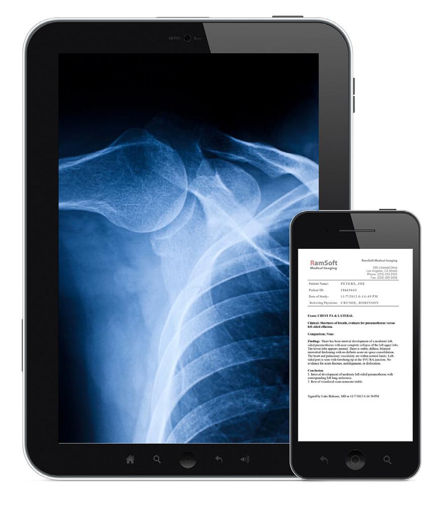 RapidResults For Physicians On-the-Go RapidResults is a powerful, zero-footprint, clinical image and report viewer that provides physicians easy access to studies via their smartphones, tablets,
