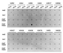 Immunofluorescence analysis of 293T cell using Histone H3R8 Dimethyl Symmetric (H3R8me2s)