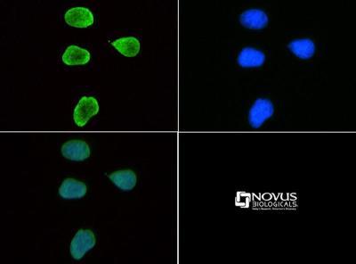 Immunocytochemistry/Immunofluorescence: Histone H3 [Trimethyl Lys9] Antibody [NB21-1073] - Immunofluorescence: [NB21-1073] -