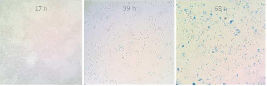 Microspcopy Dry matter Protein (crystals):
