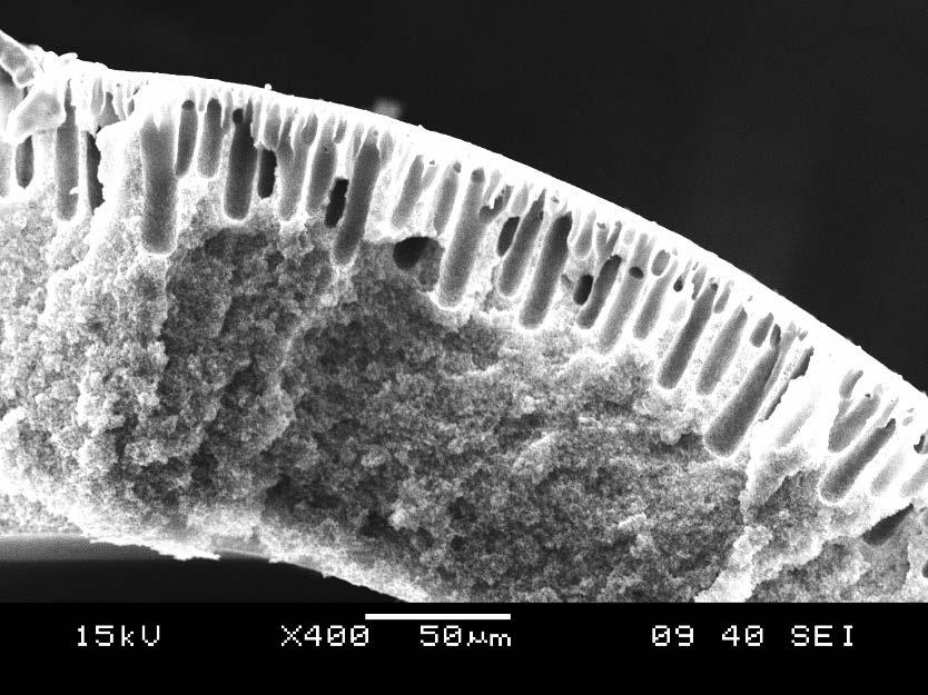 4 µm (smaller than bacteria) Water