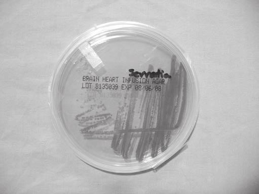 Using Sterile Technique to Inoculate Bacterial Plates A sterile, or aseptic, technique is used to prevent microbial organisms from contaminating any surface other than the specific location where