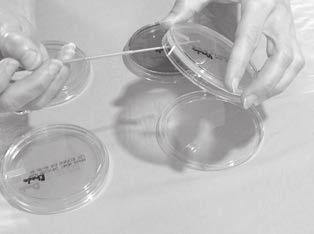 The covers to the media plates should always remain closed and should be lifted only enough to allow the inoculating loop to spread the bacteria.