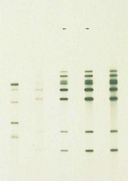 A DNA fingerprint Is a specific pattern of bands of RFLP markers on a gel Defendant s