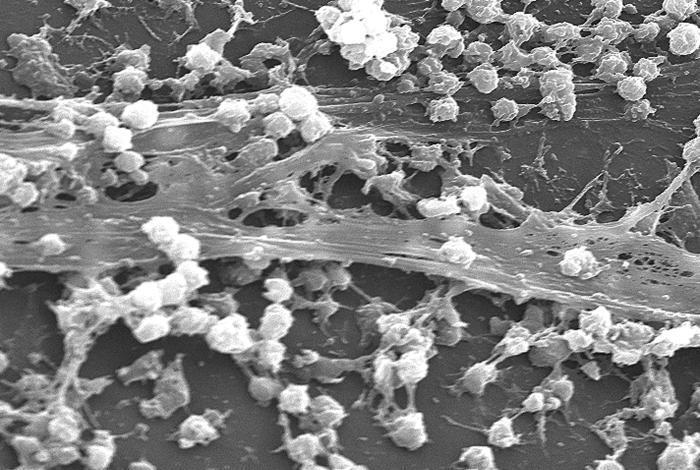 Bacterial Biofilms Biofilms: Composed primarily of polysaccharides, protein, DNA, and bacterial cells Prevalent in infections (respiratory tract, urinary tract) and foreign implants (heart valves,