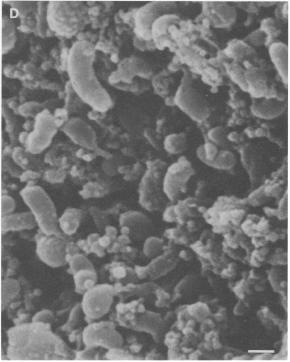 MIC and microbial biofilms Localized pitting starts with formation of bacterial biofilms 3D communities adhere to surfaces MIC: Variety of mechanisms and organisms H 2 S production by
