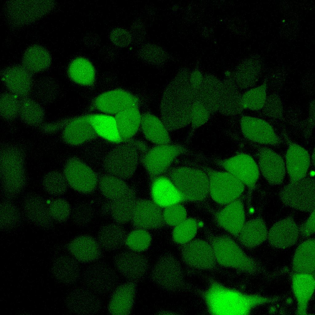 Structured Illumination Imaging of cell in FITC channel (left) and calcein