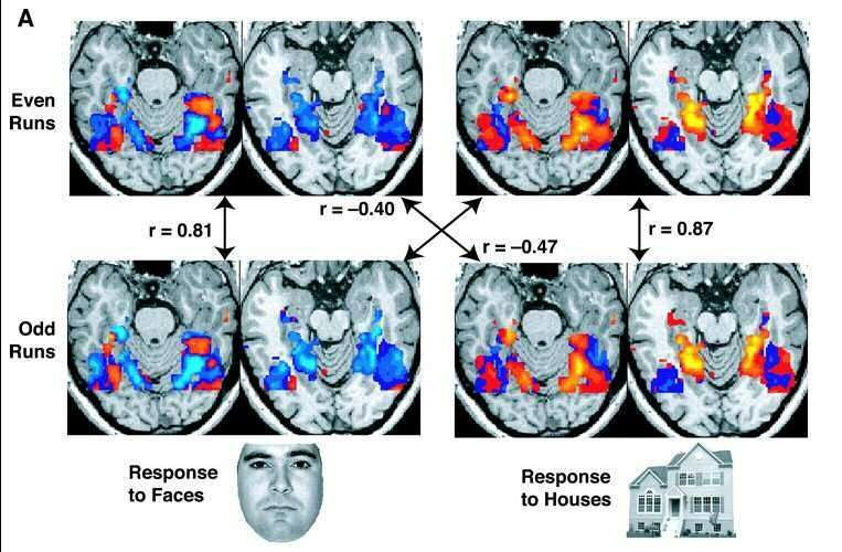 fmri: Functional MRI: An MRI procedure that measures brain activity by detecting associated changes in cerebral blood flow.