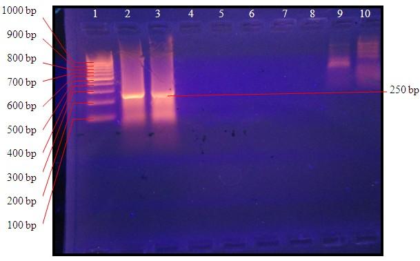 Fig(3): PCR product with NK104-NK105 primer which gave 250 bp band on agarose gel corresponding when compared to the molecular ladder.