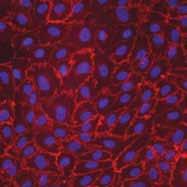 Expression of Cell-Specific Markers ATCC PCS-1-1 ATCC Primary Cell Solutions umbilical vein endothelial cells were stained for vascular endothelial cadherin (ve cadherin) as a marker for endothelial