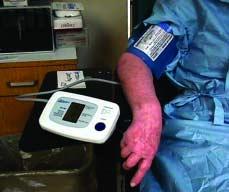 Figure 7. An individual blood pressure monitor remains on each patient until his surgery is complete. keep the flow moving. We have a one-or facility, but we move at a rapid pace.