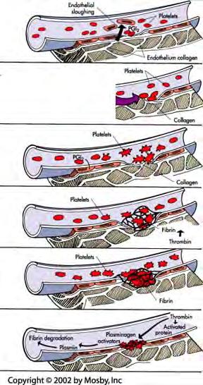 (platelet plug) Injury Collagen exposed Platelets aggregate and respond to cytokines Fibrin meshwork Electron