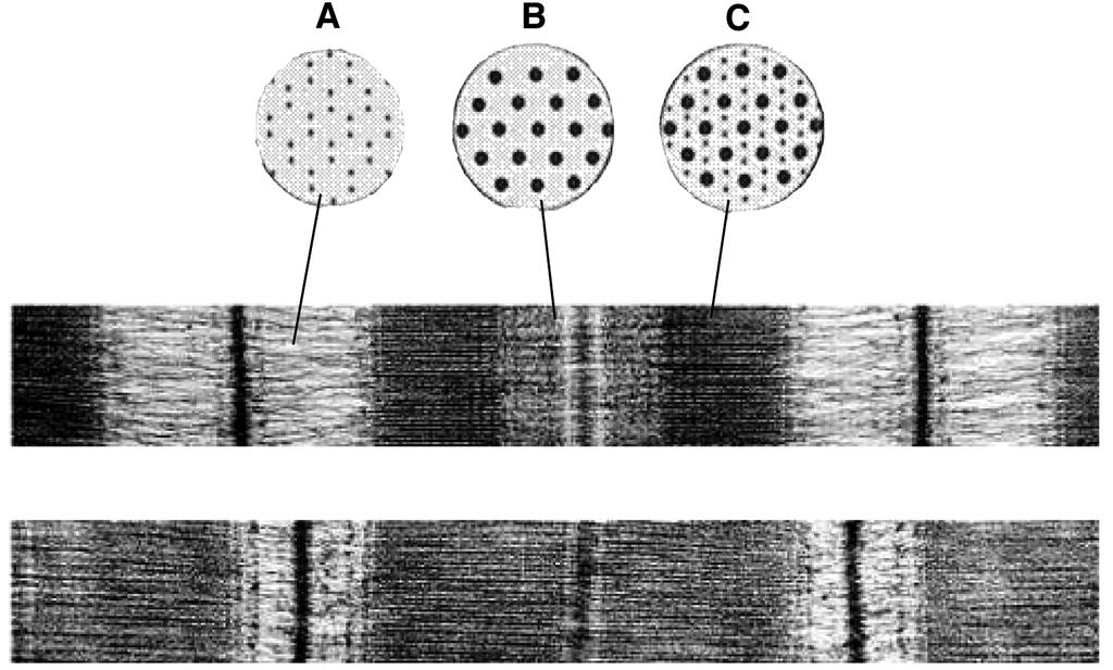 24 10 Figure 5 shows sections through relaxed and contracted myofibrils of a skeletal muscle. The transverse sections are diagrams. The longitudinal sections are electron micrographs.