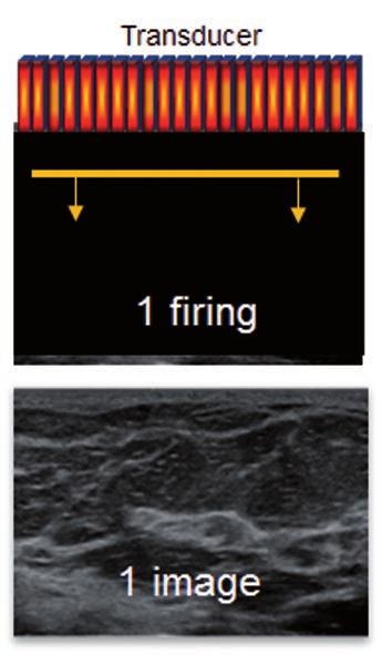 relies on two key pillars to achieve that goal: unfocused or plane waves and 3D wall filtering. Fig. 3. Continuous acquisition of flow imaging.