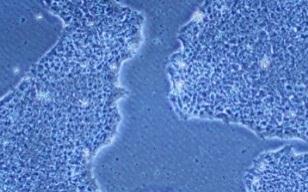 Cell human ips cells (201B7 strain) StemSure hpsc Medium Δ + 35ng/ml bfgf Matrigel hesc-qualified Matrix Caution As it