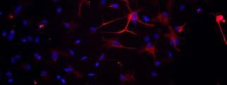 (red) (panel A), for the neuronal marker, Dcx (red) (panel B), for