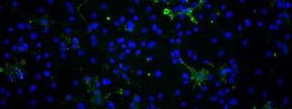 Cells were stained for the undifferentiated NSC marker, nestin