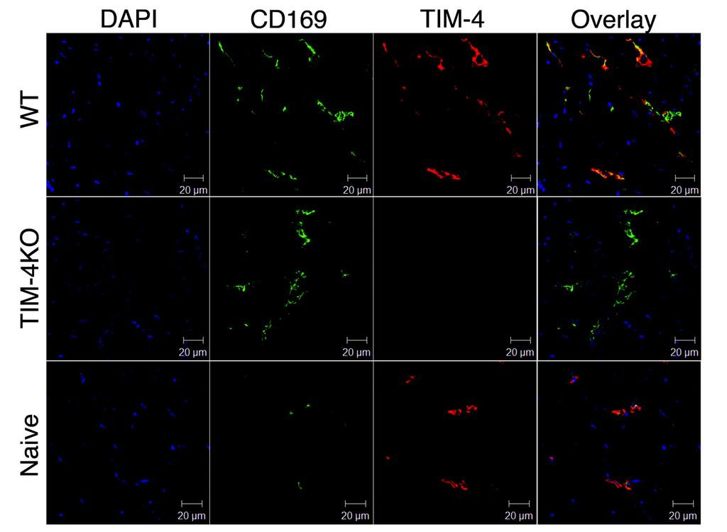 Supplemental Figure 5: CD169 + macrophages in donor hearts are donor-derived and co-express TIM-4.
