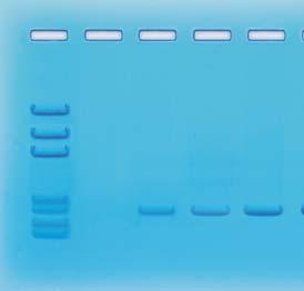 INSTRUCTOR'S GUIDE Experiment Results and Analysis ( - ) 1 2 3 4 5 ( - ) 1 2 3 4 5 6751 bp 3652 bp 2827 bp 1568 bp 1118 bp 825 bp 630 bp ( + ) ( + ) Lane 1 2 3 4 5 Sample Name DNA Standard Marker