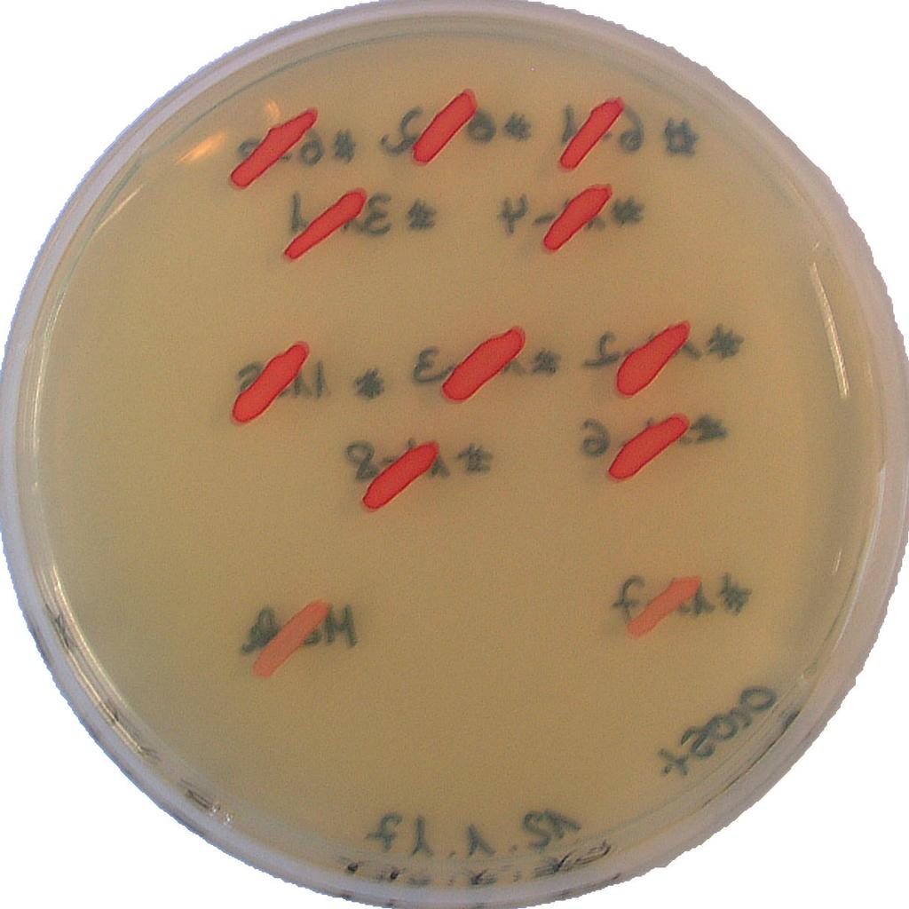 A TTC overlay mixture (1,5% agar; 0,067M phosphate buffer ph7) has been generated by autoclaving.